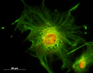 Fluoreszenzmarkierung bei einer Knochenstammzelle © H. J. Rolf/Göttingen